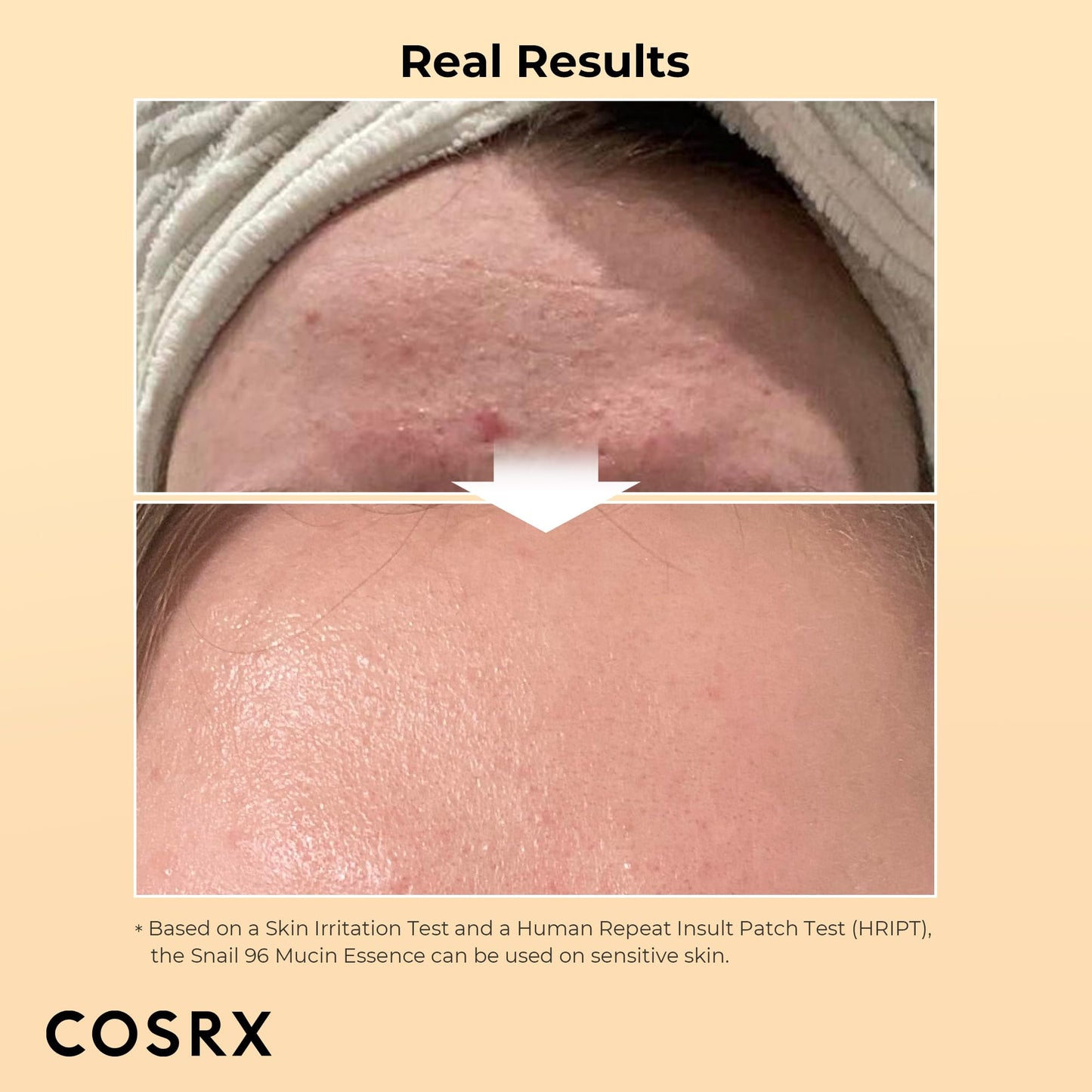 COSRX - Snail Mucin 96% Power Repairing Essence 3.38 fl.oz 100ml, Hydrating Serum for Face with Snail Secretion Filtrate for Dull Skin & Fine Lines, Korean Skin Care